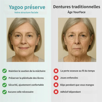 🌎Dernière chance ! 70 % de réduction sur la prothèse dentaire complète médicale à forte succion, aujourd‘hui seulement !