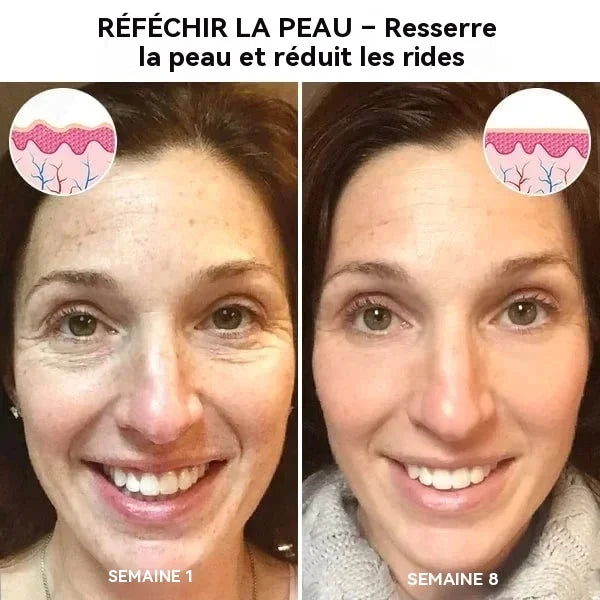 Dernier jour de promotion : 50 % de réduction sur le sérum visage Botox