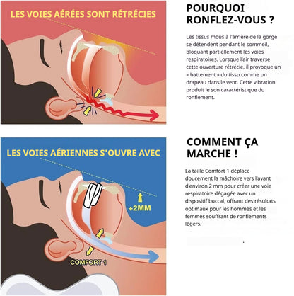Protège-dents anti-ronflement et bruxisme
