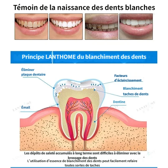 🔥Meilleures ventes - Essence de blanchiment des dents