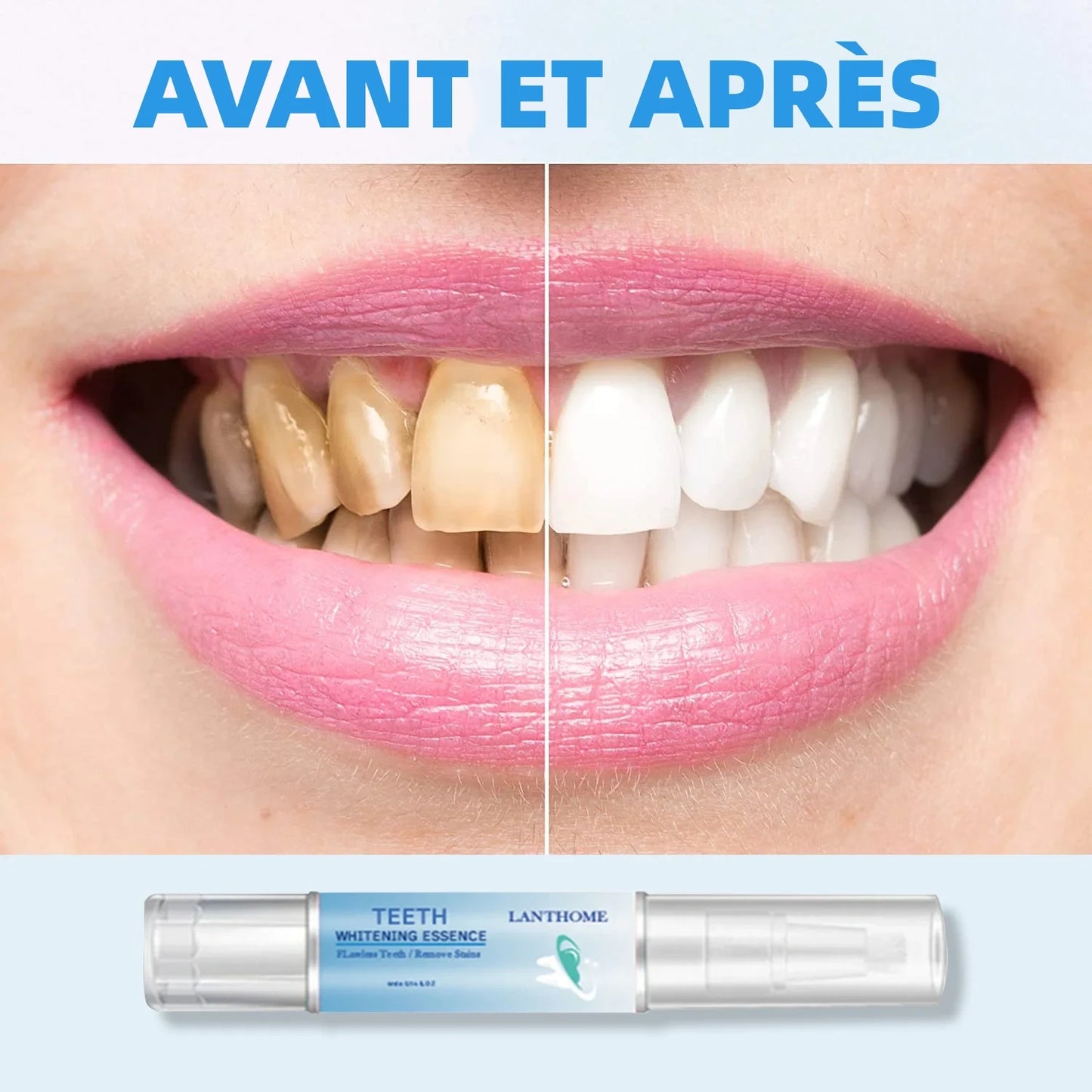 🔥Meilleures ventes - Essence de blanchiment des dents