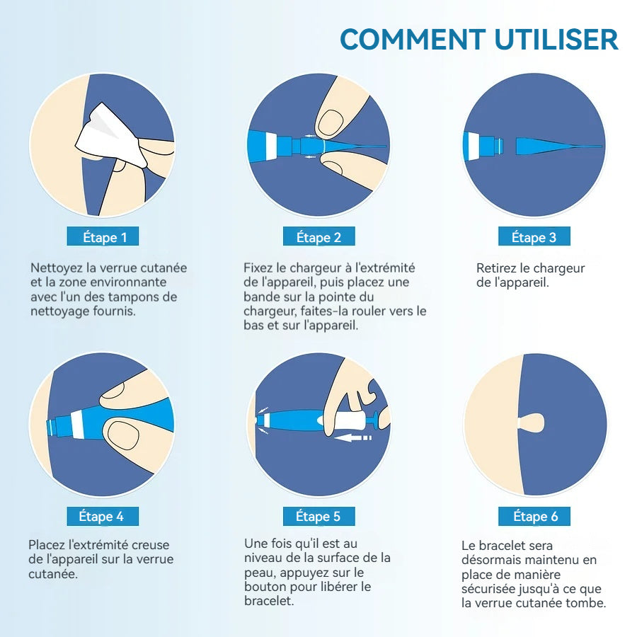 Outil double tête pour l'élimination des verrues - Éliminez vos verrues cutanées sans douleur à domicile